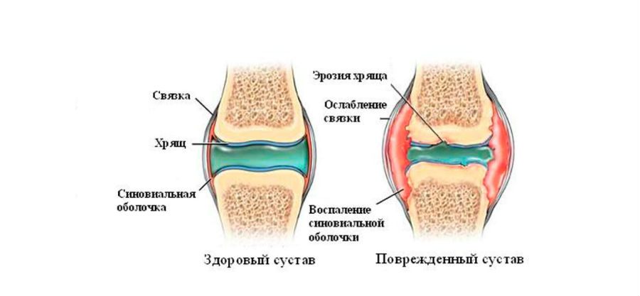 лечение суставов днепр