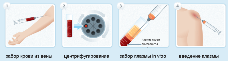 ортоплазма днепр