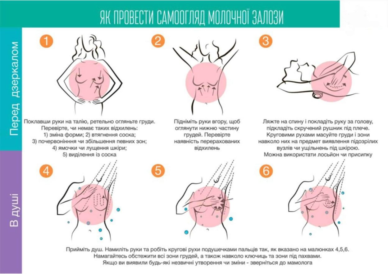 самообследование молочных желез днепр