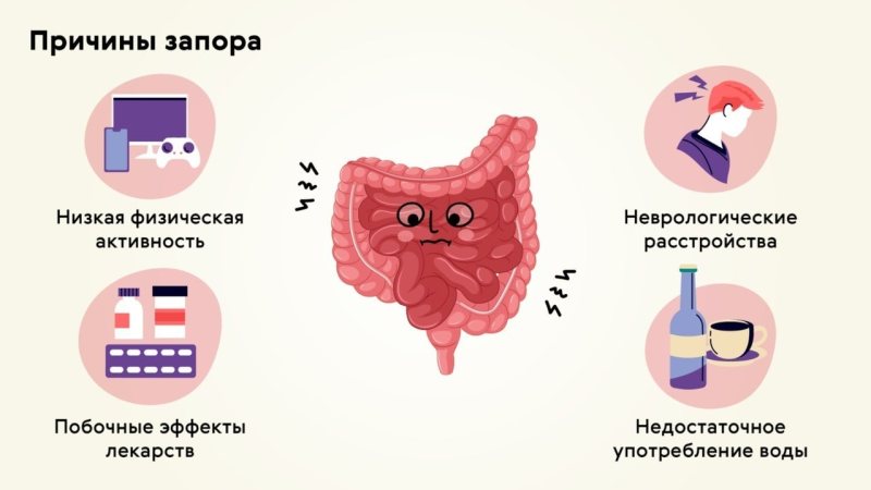 лечим запор в домашних условиях