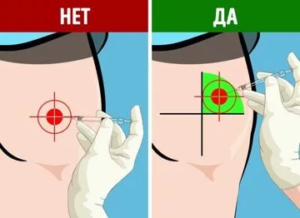 куда делать укол